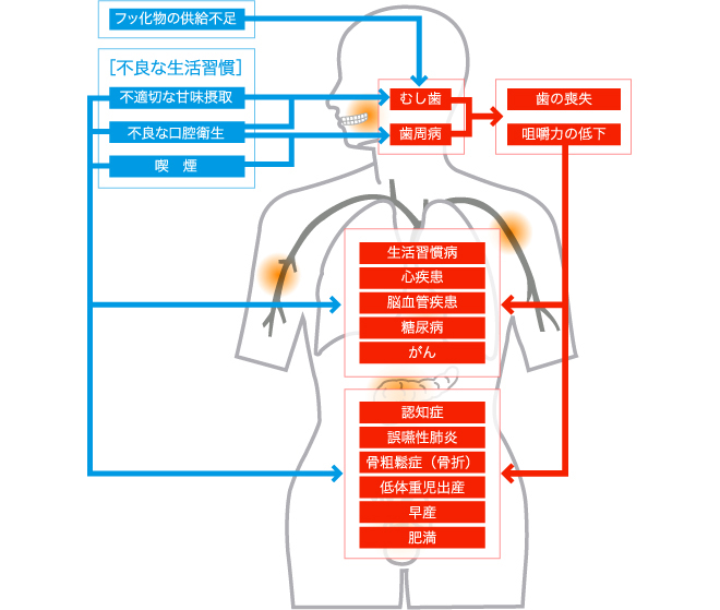 歯周病を悪化させる原因