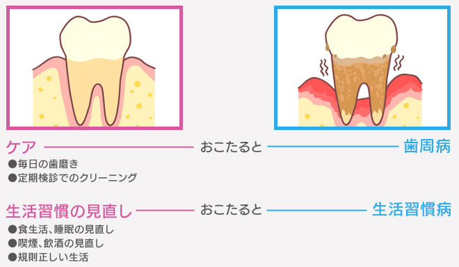 歯周病は感染症という面と、生活習慣病という面を合わせ持った病気です